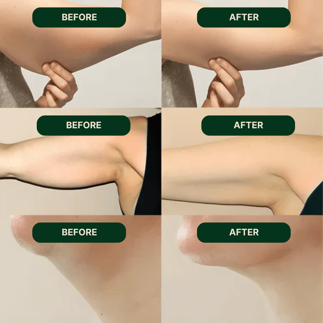 Reduce puffiness and bloating with NutriMuse