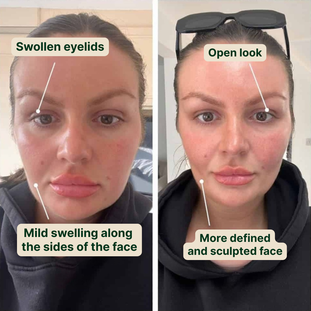 Reduce puffiness and bloating with NutriMuse