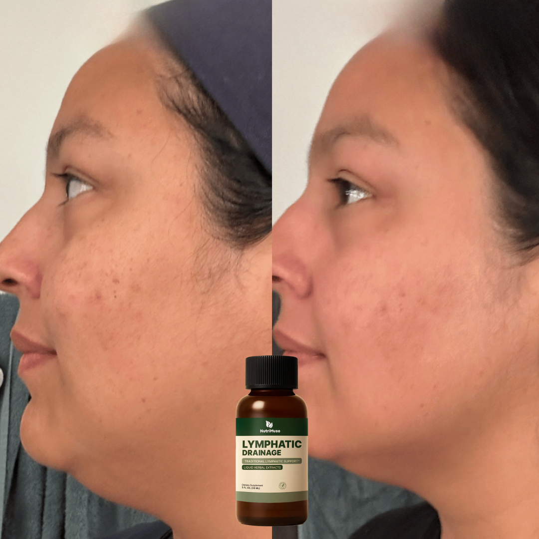 NutriMuse Lymphatic Drainage Drops